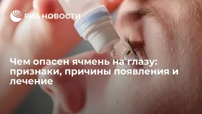 Как быстро и безопасно избавиться от ячменя на глазу | Ячмень, Темные круги  под глазами, Косметолог