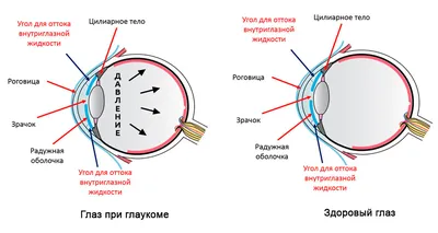 Лечение глаукомы в Москве, диагностика и лечение глаукомы в Центре  Терапевтической Офтальмологии