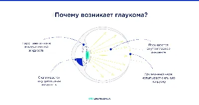 Лечение глаукомы - РКОБ им. проф. Е.В. Адамюка