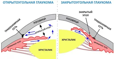 Если у деда глаукома – заболеет и внук? | Эксимер, офтальмологическая  клиника | Дзен