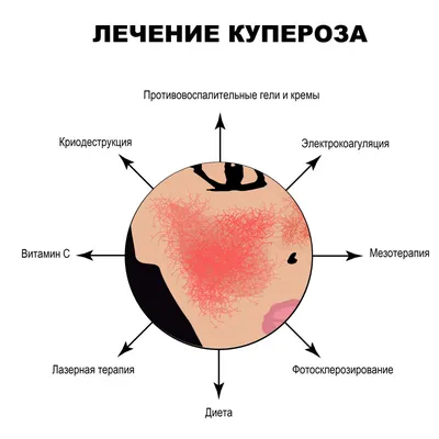 Чувствительная кожа и купероз. Правила ухода