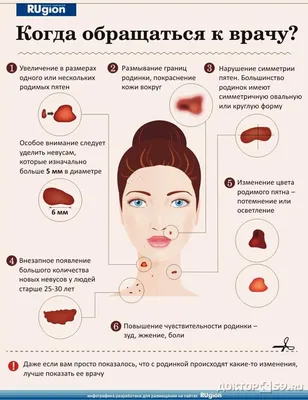 Лечение меланомы кожи в Новосибирске | ФГБУЗ Сибирский окружной медицинский  центр