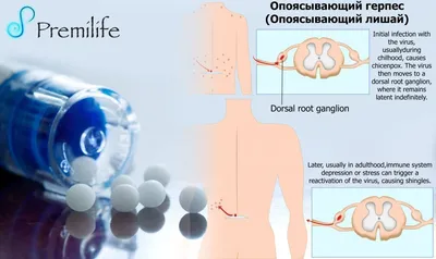 Опоясывающий лишай (герпес): симптомы и лечение - полезная информация на  сайте