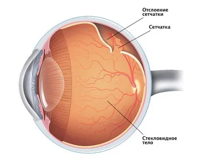 Лечение заболеваний сетчатки глаза в Санкт-Петербурге - цены в клинике  «Счастливый Взгляд»