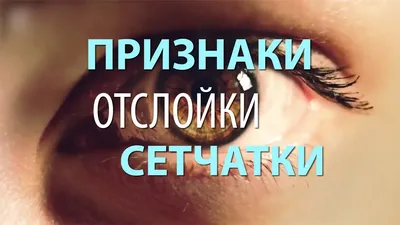 Строение глаза человека | Люксоптика