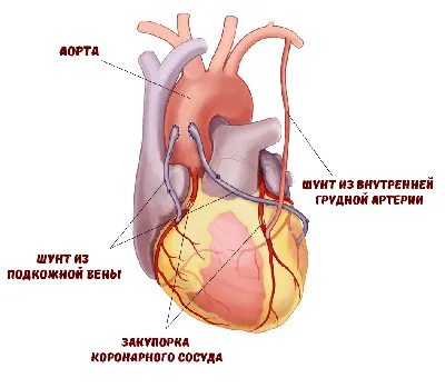 Аортокоронарное шунтирование в Израиле – $ Цены, отзывы | DoktorIsrael