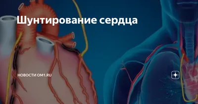 Шунтирование сосудов сердца: коронарное шунтирование в Одессе | Медицинский  дом Odrex