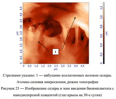 Склеральные линзы Хоррор Red, красные склеры 22 мм. (N0060)  (ID#1219396109), цена: 2200 ₴, купить на Prom.ua