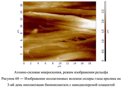 Изменения оптической системы глаза после кругового вдавления склеры – тема  научной статьи по клинической медицине читайте бесплатно текст  научно-исследовательской работы в электронной библиотеке КиберЛенинка