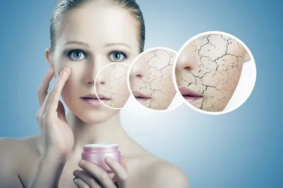 Как распознать чувствительную кожу лица