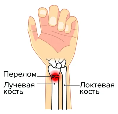 Здоровье человека можно оценить по рукам - KP.RU