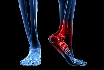 Лечение суставов: лечение коленного и тазобедренного сустава, артрит, артроз