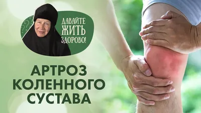 Лечение артрита локтевого сустава в Москве | Многопрофильная клиника  «Доктор Лидер»