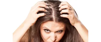 Алопеция бровей - почему выпадают волосы на бровях, лечение, причины,  симптомы, профикактика