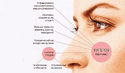 Демодекоз - причины, симптомы, диагностика и лечение демодекса на лице |  MriyaMed