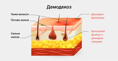 Демодекоз век — описание, причины и лечение