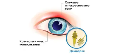 ПОД СТЕКЛОМ: ДЕМОДЕКОЗ. Как диагностировать и лечить. - в Москве