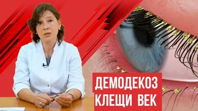 Заболевание век | PROMED