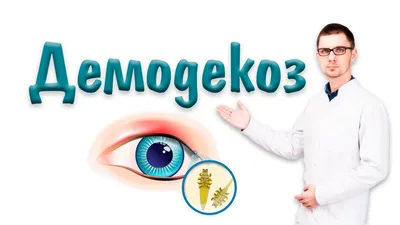 Демодекоз век. Быстрый путь вылечить демодекоз глаз - Demodex Complex