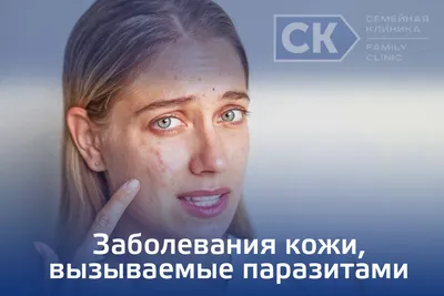 Cosmetologist Ли - Демодекс, являясь частью флоры дермы, присутствует  практически у всех людей. Клещ имеет микроскопические размеры, и обнаружить  его без микроскопа невозможно. Он питается отмершими клетками кожи, не  вызывая патологических процессов.