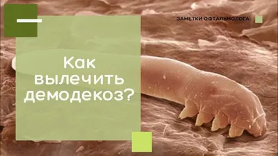 Гель-актив для век Эпидерил Demodex с метронидазолом и травами 100 мл -  купить в интернет-магазинах, цены на Мегамаркет | лечебно-косметические  средства