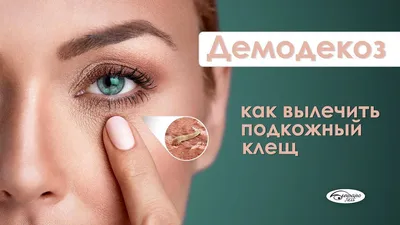 Демодекс Комплекс®» Вечерний крем от демодекоза (Синьшэн) - Demodex Complex