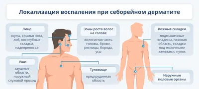 Как избавиться от перхоти на голове: что помогает и чем лечить?