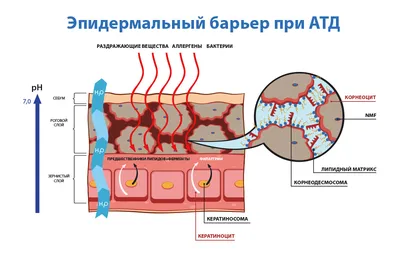 Лечение себорейного дерматита волосистой части головы и лица