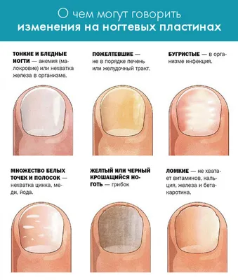 Микросп... - Центр диагностики кожи Клиника доктора Андрейчева | Facebook
