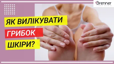 Лечение микоза и грибковых заболеваний кожи | ESTET-PORTAL | Дзен