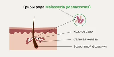 КОСМЕТОЛОГ /ДЕРМАТОЛОГ/ ОНКОЛОГ on Instagram: \"Дерматофития является  инфекционной кожной болезнью, которую вызывают дерматофиты.  Распространители этой инфекции, как правило, животные и дети. Причины  дерматофитии Причиной болезни являются грибы ...