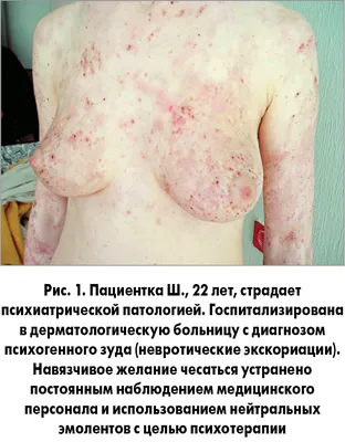 Дерматология Киева - Консультации опытных дерматологов