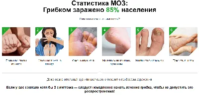 ✔️ Протезирование ногтевой пластины на ногах и руках - podonails.com