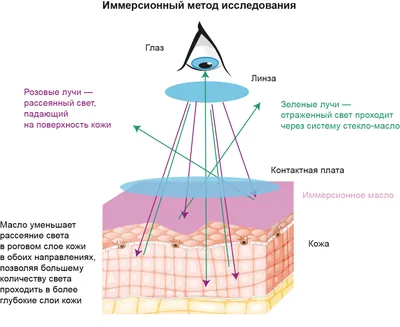 Skinjoy on Instagram: \"Дерматоскопия является стандартом диагностики  новообразований кожи, и в обязательном порядке проводится перед удалением  любого новообразования (родинки, папилломы, бородавки, невуса и т. д.), она  позволяет по внешним признакам ...