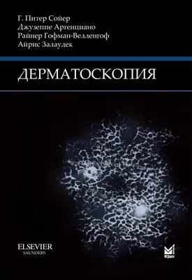 Что такое цифровая дерматоскопия? - Национальный центр хирургии