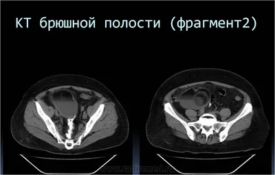 Дистихиаз у собак - ветеринарная офтальмология Реком