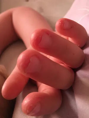 Как перестать грызть ногти – полезные советы