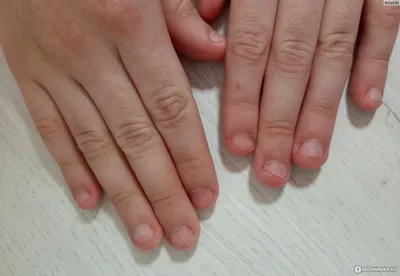 Как перестать грызть ногти, как избавить ребенка от привычки грызть ногти?