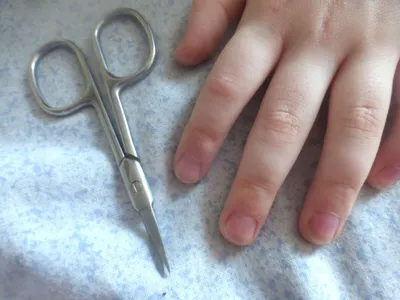 Как отучить ребёнка грызть ногти?