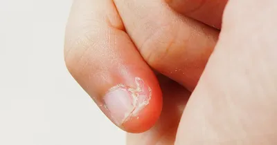 Ребёнок грызет ногти: как побороть привычку | Блог для родителей Lucky  Child | Дзен
