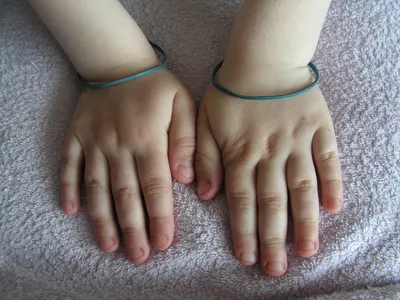 Как отучить ребенка грызть ногти: 4 простых способа - IVONA.UA