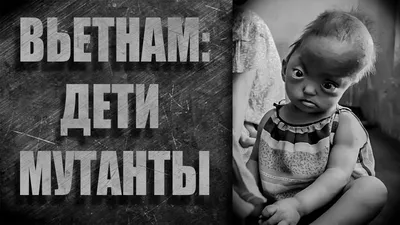 Байки от антиваксеров: привитые от ковида турчанки рожают детей-мутантов