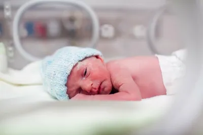 Новорожденная девочка с пороком сердца перенесла операцию - YouTube