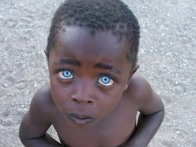 Как наследуется цвет глаз и почему у некоторых людей глаза разного цвета -  Летидор