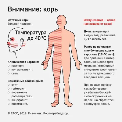 Корь у детей: симптомы, профилактика и лечение