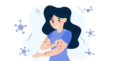 ᐈ Пищевая аллергия: симптомы и лечение ~【Киев】