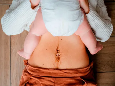 Диастаз после родов: как восстановить расхождение прямых мышц живота
