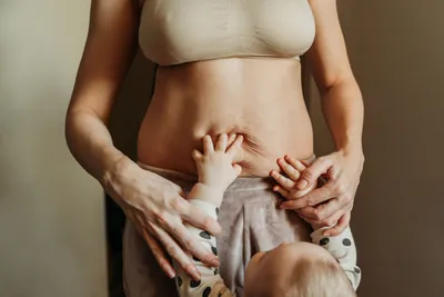 Диастаз после родов: как восстановить расхождение прямых мышц живота