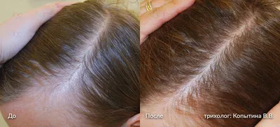 Врач диагностики и лечения волос от выпадения в сети клиник НИАРМЕДИК