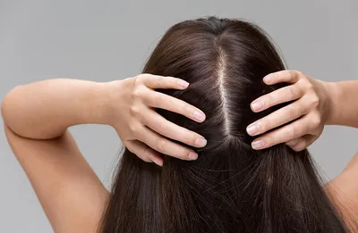 Выпадение волос от стресса: что делать и как лечить, если выпадают волосы  от стресса – Лаборатория Ан-Тек